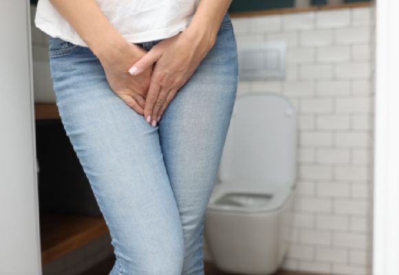 Stress Urinary Incontinence (SUI) in Women